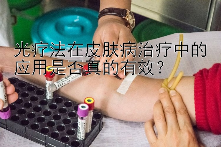 光疗法在皮肤病治疗中的应用是否真的有效？